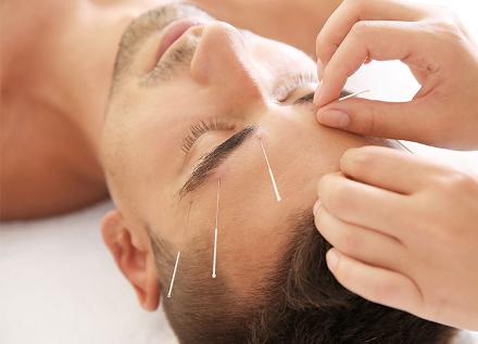 Facial acupuncture treatment
